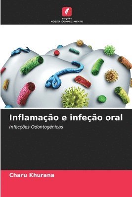 Charu Khurana - Inflamação e infeção oral, Häftad