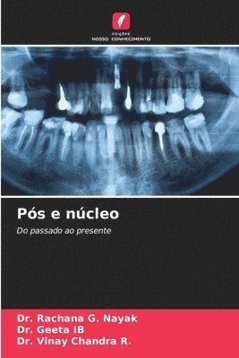 Rachana G Nayak, Geeta Ib, Vinay Chandra R, Rachana G. Nayak, Dr. Rachana G. Nayak, DR. GEETA IB, Vinay Chandra R. - Pós e núcleo, Häftad