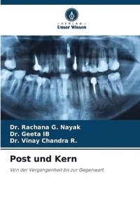 bokomslag Post und Kern
