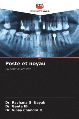 Rachana G Nayak, Geeta Ib, Vinay Chandra R, Rachana G. Nayak, Dr. Rachana G. Nayak, DR. GEETA IB, Vinay Chandra R. - Poste et noyau, Häftad