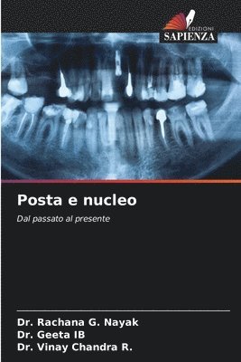 Rachana G Nayak, Geeta Ib, Vinay Chandra R, Rachana G. Nayak, Dr. Rachana G. Nayak, DR. GEETA IB, Vinay Chandra R. - Posta e nucleo, Häftad