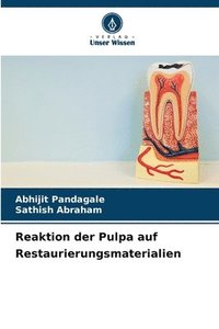 bokomslag Reaktion der Pulpa auf Restaurierungsmaterialien