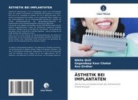 bokomslag ÄSTHETIK BEI IMPLANTATEN