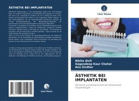 bokomslag ÄSTHETIK BEI IMPLANTATEN
