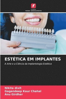 Nikita Dixit, Gagandeep Kaur Chahal, Anu Girdhar - Estética Em Implantes, Häftad