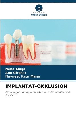 Neha Ahuja, Anu Girdhar, Navneet Kaur Mann - Implantat-Okklusion, Häftad