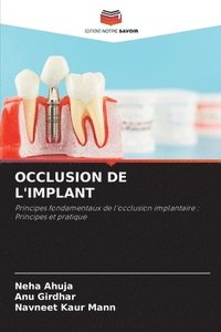bokomslag Occlusion de l'Implant