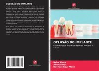 bokomslag OCLUSÃO DO IMPLANTE