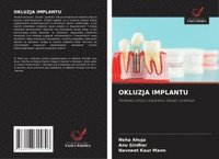 bokomslag OKLUZJA IMPLANTU