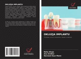 bokomslag OKLUZJA IMPLANTU