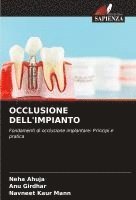 bokomslag OCCLUSIONE DELL'IMPIANTO