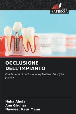 Neha Ahuja, Anu Girdhar, Navneet Kaur Mann - Occlusione Dell'impianto, Häftad