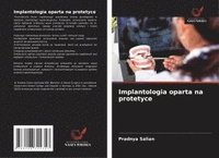 bokomslag Implantologia oparta na protetyce