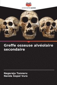 bokomslag Greffe osseuse alvéolaire secondaire