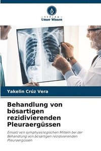 bokomslag Behandlung von bösartigen rezidivierenden Pleuraergüssen