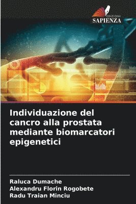 Individuazione del cancro alla prostata mediante biomarcatori epigenetici