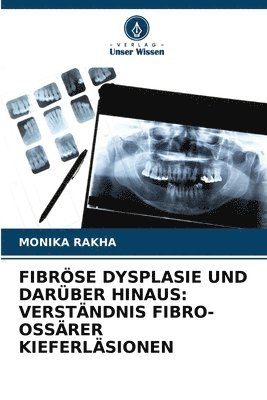 bokomslag Fibröse Dysplasie Und Darüber Hinaus: Verständnis Fibro-Ossärer Kieferläsionen