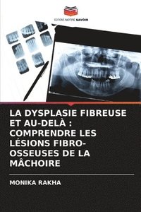 bokomslag La Dysplasie Fibreuse Et Au-Delà: Comprendre Les Lésions Fibro-Osseuses de la Mâchoire