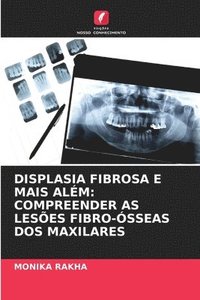 bokomslag Displasia Fibrosa E Mais Além: Compreender as Lesões Fibro-Ósseas DOS Maxilares