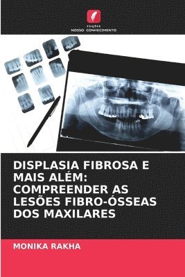bokomslag Displasia Fibrosa E Mais Além: Compreender as Lesões Fibro-Ósseas DOS Maxilares