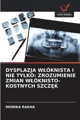 bokomslag DYSPLAZJA W¿ÓKNISTA I NIE TYLKO: ZROZUMIENIE ZMIAN W¿ÓKNISTO-KOSTNYCH SZCZ¿K
