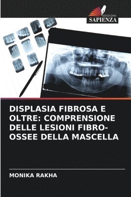 bokomslag DISPLASIA FIBROSA E OLTRE: COMPRENSIONE DELLE LESIONI FIBRO-OSSEE DELLA MASCELLA