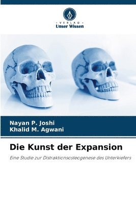 Kunst der Expansion