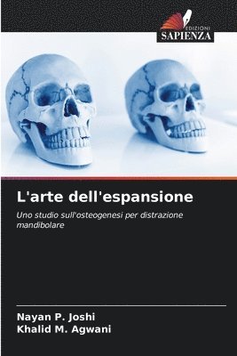 Nayan P Joshi, Khalid M Agwani, Nayan P. Joshi, Khalid M. Agwani, khalid M. Agwani - L'arte dell'espansione, Häftad