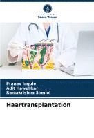 bokomslag Haartransplantation