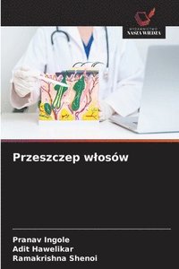 bokomslag Przeszczep wlosów