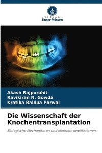bokomslag Die Wissenschaft der Knochentransplantation