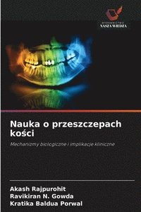 bokomslag Nauka o przeszczepach ko?ci
