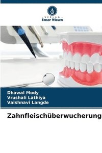 bokomslag Zahnfleischüberwucherung