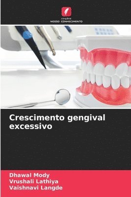 Dhawal Mody, Vrushali Lathiya, Vaishnavi Langde - Crescimento gengival excessivo, Häftad
