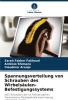 bokomslag Spannungsverteilung von Schrauben des Wirbelsäulen-Befestigungssystems