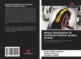 bokomslag Stress distribution of vertebral fixation system screws