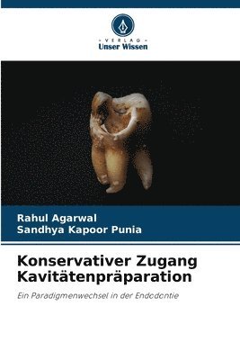 Rahul Agarwal, Sandhya Kapoor Punia - Konservativer Zugang Kavitätenpräparation, Häftad