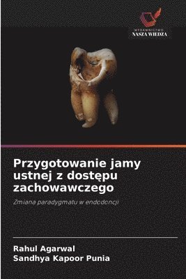 Rahul Agarwal, Sandhya Kapoor Punia - Przygotowanie jamy ustnej z dostępu zachowawczego, Häftad