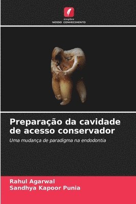 bokomslag Preparação da cavidade de acesso conservador