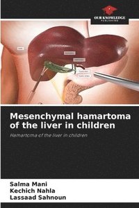 bokomslag Mesenchymal hamartoma of the liver in children