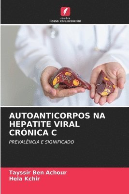 bokomslag AUTOANTICORPOS NA HEPATITE VIRAL CRÓNICA C