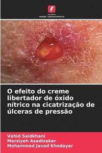 bokomslag O efeito do creme libertador de óxido nítrico na cicatrização de úlceras de pressão