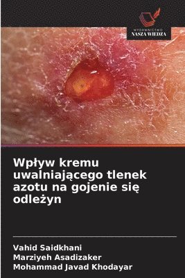 bokomslag Wplyw kremu uwalniaj?cego tlenek azotu na gojenie si? odle?yn