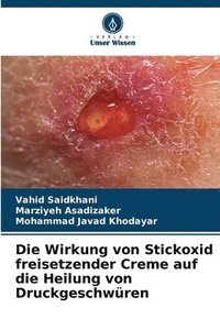 bokomslag Die Wirkung von Stickoxid freisetzender Creme auf die Heilung von Druckgeschwüren