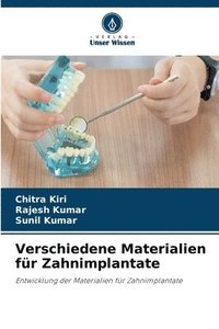 bokomslag Verschiedene Materialien für Zahnimplantate