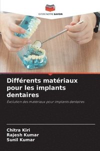bokomslag Différents matériaux pour les implants dentaires