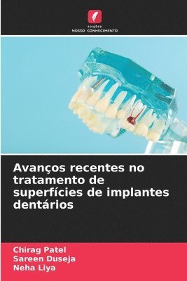 Chirag Patel, Sareen Duseja, Neha Liya - Avanços recentes no tratamento de superfícies de implantes dentários, Häftad