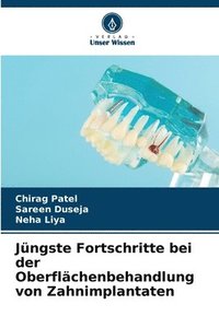 bokomslag Jüngste Fortschritte bei der Oberflächenbehandlung von Zahnimplantaten