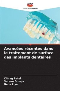 bokomslag Avancées récentes dans le traitement de surface des implants dentaires