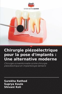 bokomslag Chirurgie piézoélectrique pour la pose d'implants: Une alternative moderne